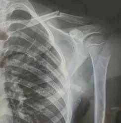 赤峰市教育局介入<strong></p>
<p>币安官方网站</strong>，家长称：孩子拨弄开关被另一班班主任打伤