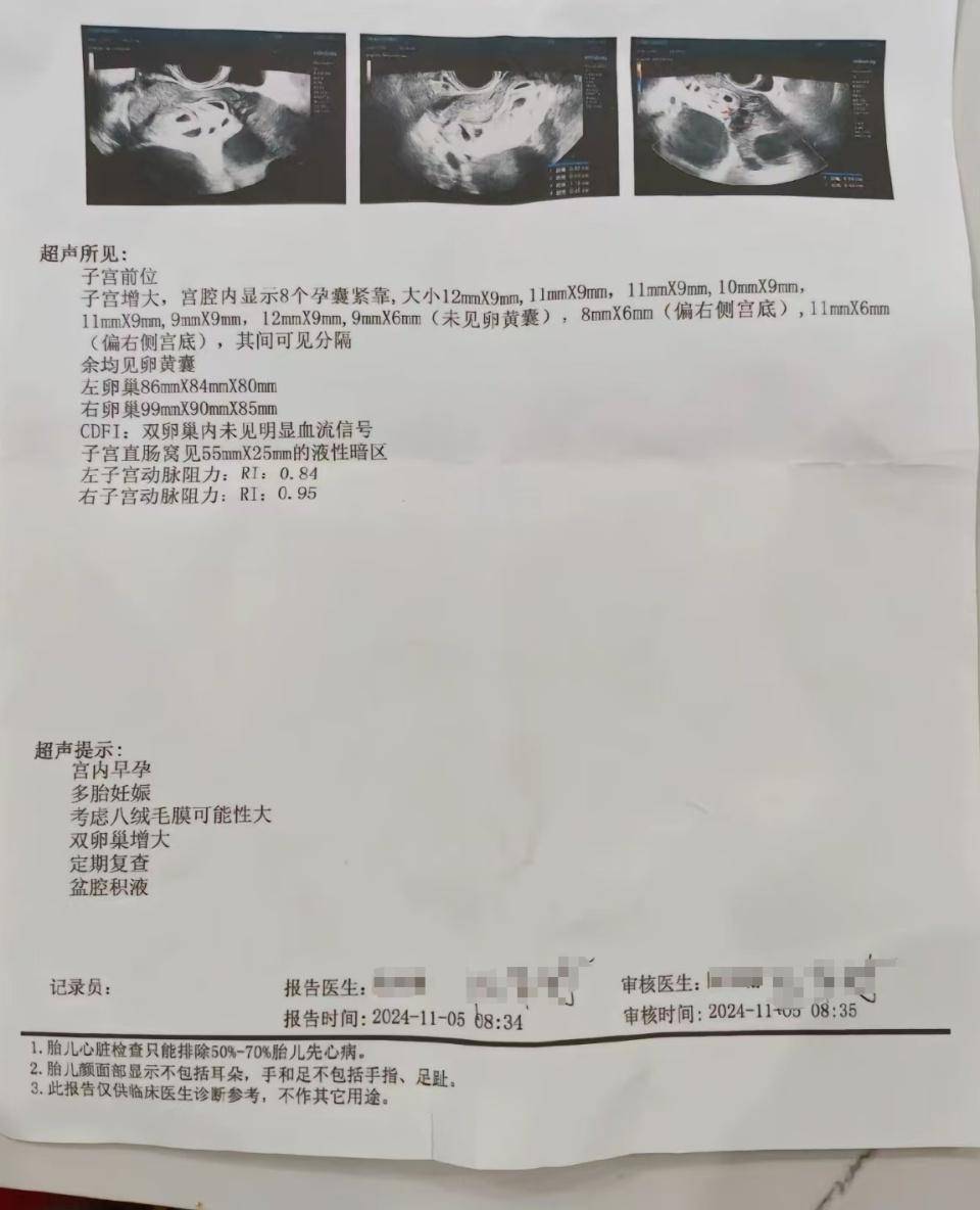 怀上9胞胎女子今日进行减胎手术:分两次进行<strong></p>
<p>币安币商</strong>,第一次减去四个胚胎,第二次减去三个