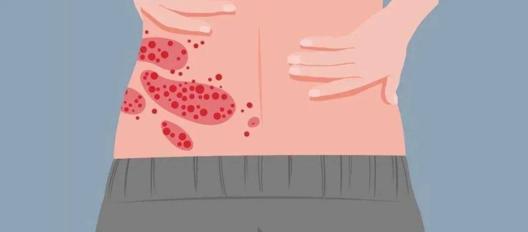 一旦感染终身携带<strong></p>
<p>币安币商</strong>！深圳疾控提醒：这4类人要注意