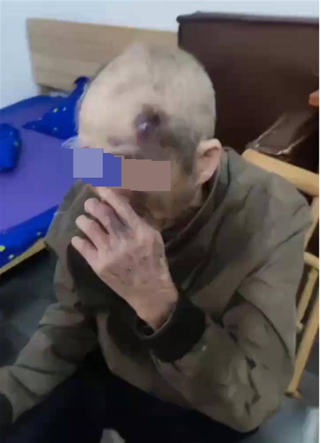 广东阳江一养老院护工长期虐待九旬老人?民政局已介入<strong></p>
<p>币安货币交易所</strong>,警方:正了解情况