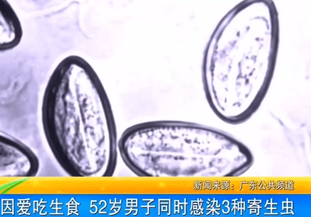 女子体内排出10米长绦虫<strong></p>
<p>币安汇率</strong>！原是两年前旅游时吃了这种食物