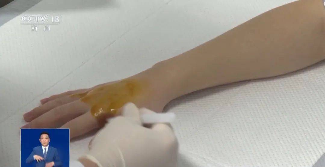 南方游客在哈尔滨“泼水成冰”受伤<strong></p>
<p>币安钱包地址</strong>!最新提醒