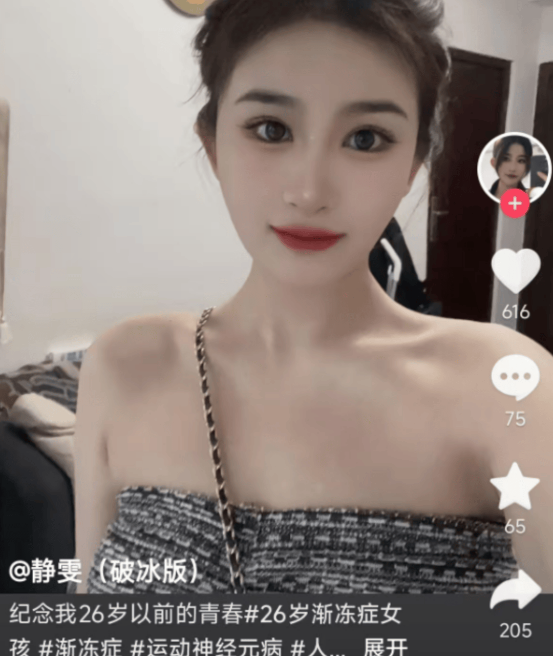 26岁渐冻症女孩去世<strong></p>
<p>币安币矿池</strong>,生前曾向蔡磊求助,确诊仅1年