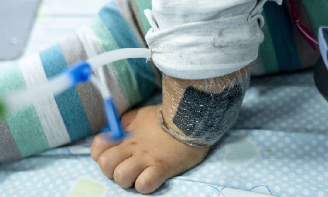 可瞬间产生近100℃高温<strong></p>
<p>币安网址</strong>!合肥医生发出提醒