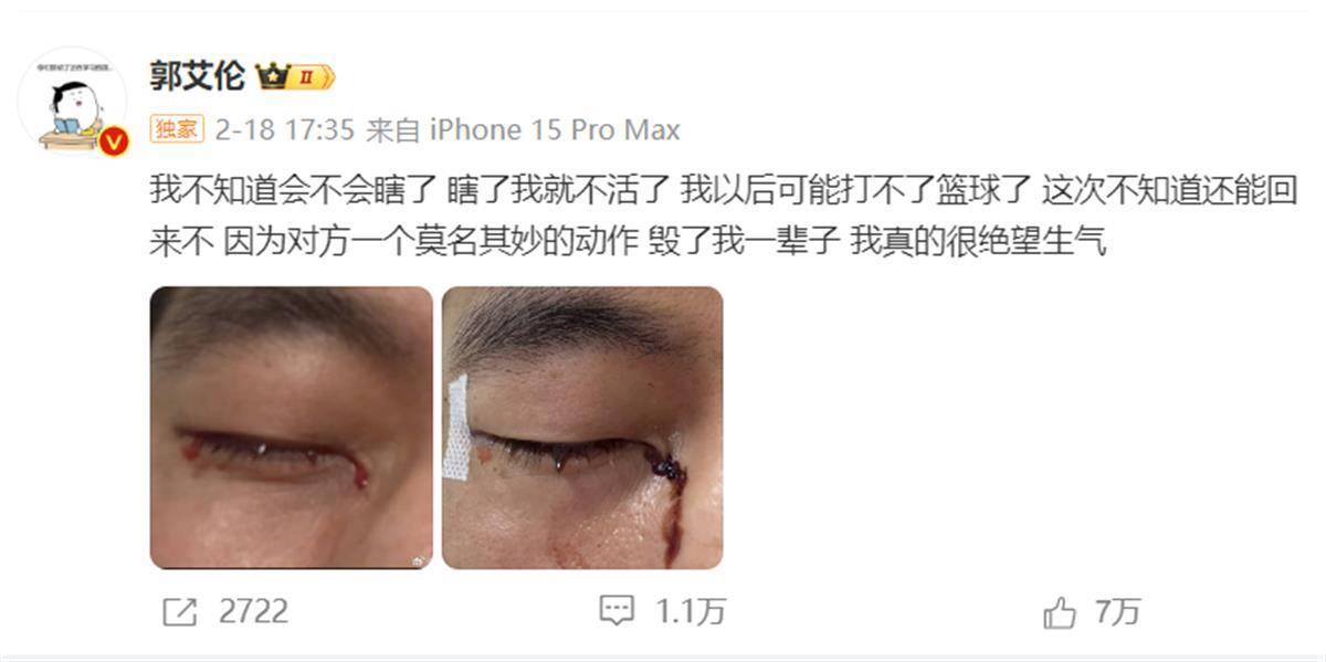 郭艾伦发文报平安:已顺利拆线<strong></p>
<p>币安网址</strong>,相信一定会重回球场