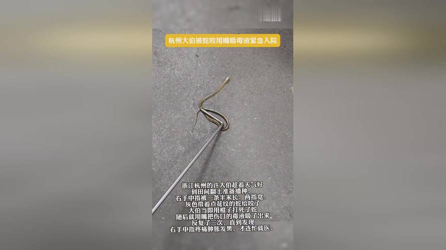 杭州大伯野外被蛇咬，用嘴吸毒液后紧急入院的惊险事件