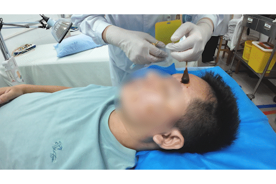 醒来“天塌了”<strong></p>
<p>币安合约上线</strong>！深圳一女子眼睛闭不上、嘴巴漏水！这些错误很多人会犯