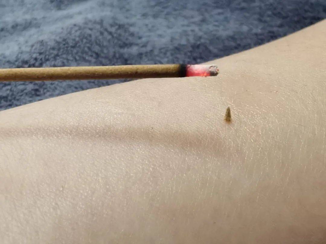 醒来“天塌了”<strong></p>
<p>币安合约上线</strong>！深圳一女子眼睛闭不上、嘴巴漏水！这些错误很多人会犯