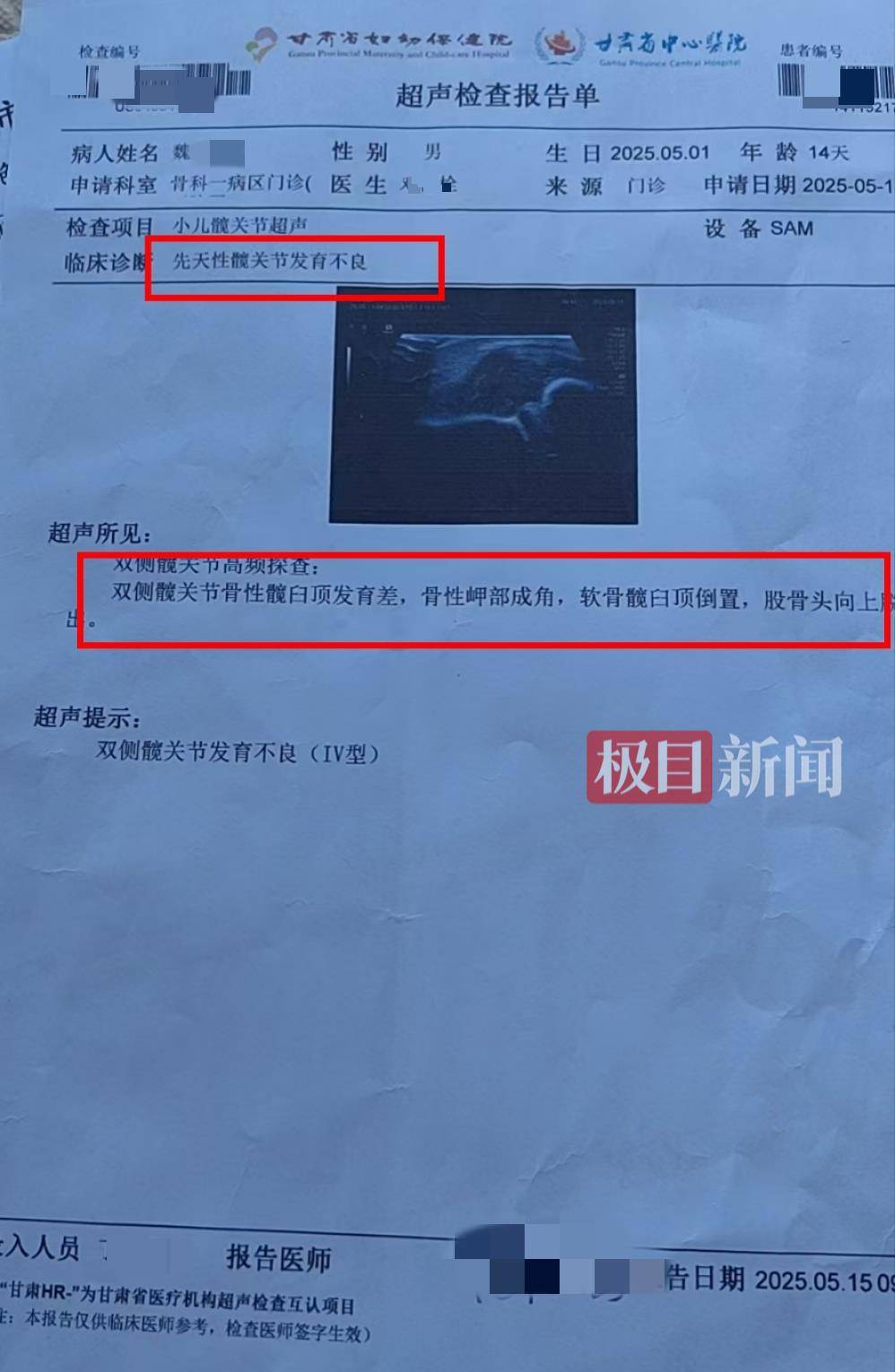 二胎出生查出先天性病症或落下残疾<strong></p>
<p>币安最新动态</strong>，残疾父母称医院产检漏检、未尽告知义务，医院及医调委回应