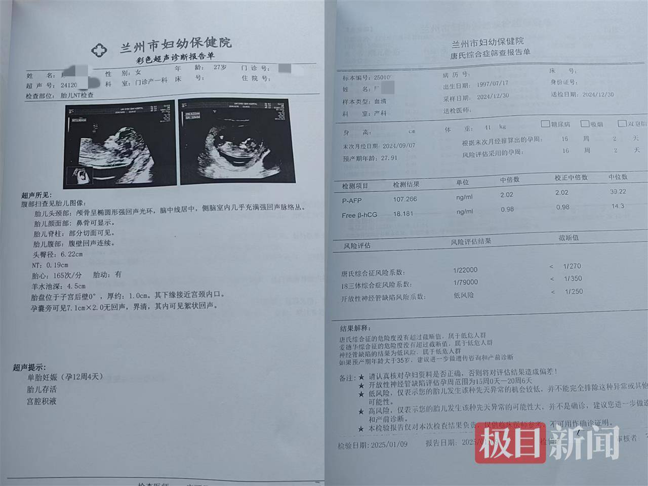 二胎出生查出先天性病症或落下残疾<strong></p>
<p>币安最新动态</strong>，残疾父母称医院产检漏检、未尽告知义务，医院及医调委回应