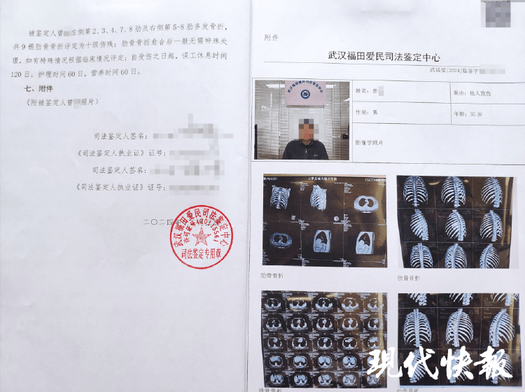 湖北一男子称被交警打断9根肋骨未立案<strong></p>
<p>币安交易所商家</strong>,警方回应