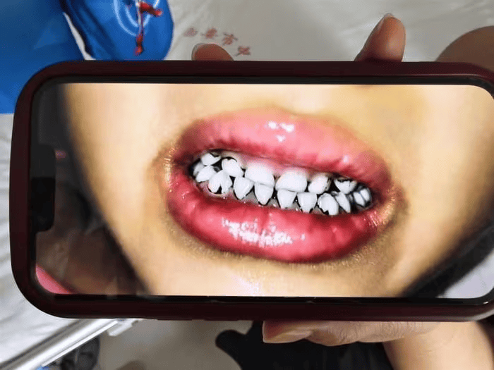 家长接到劝返电话“回甘肃去治”<strong></p>
<p>币安官网app</strong>,幼儿血铅中毒事件更多细节曝光