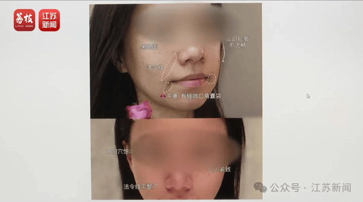 打一针“返老还童”的童颜针卖了30亿<strong></p>
<p>币安最新地址</strong>，真的有效吗？