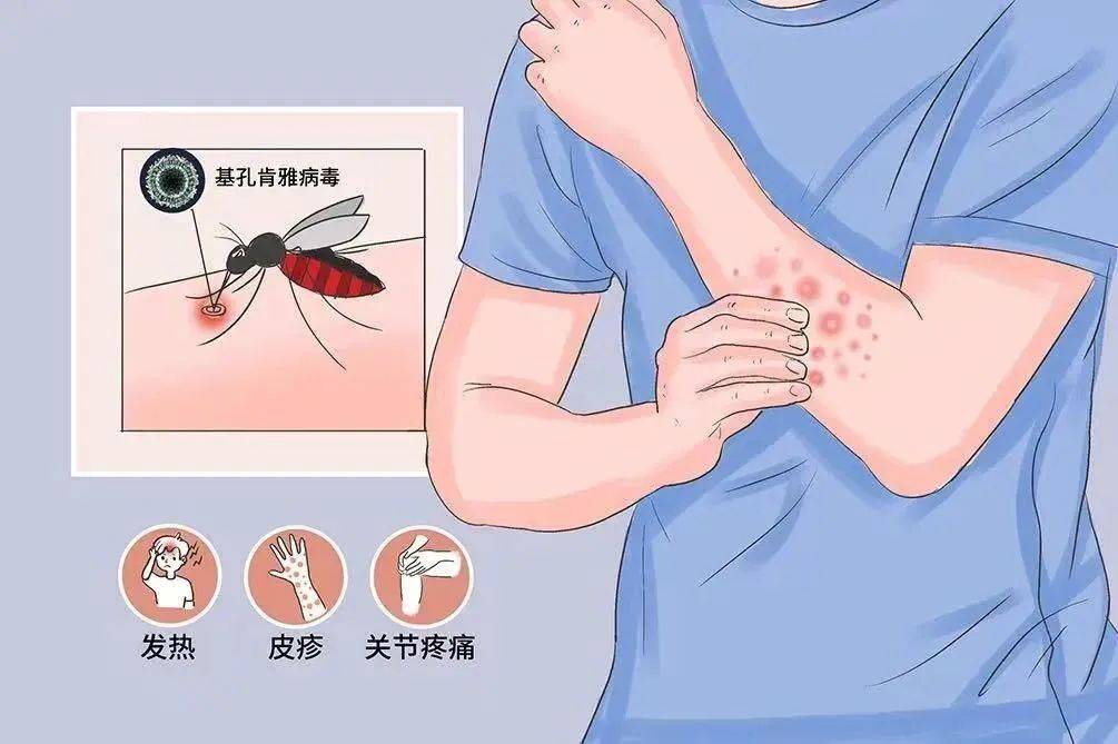 风险增大<strong></p>
<p>币安卖矿机</strong>！深圳疾控：去这247处要小心！张文宏首次发声