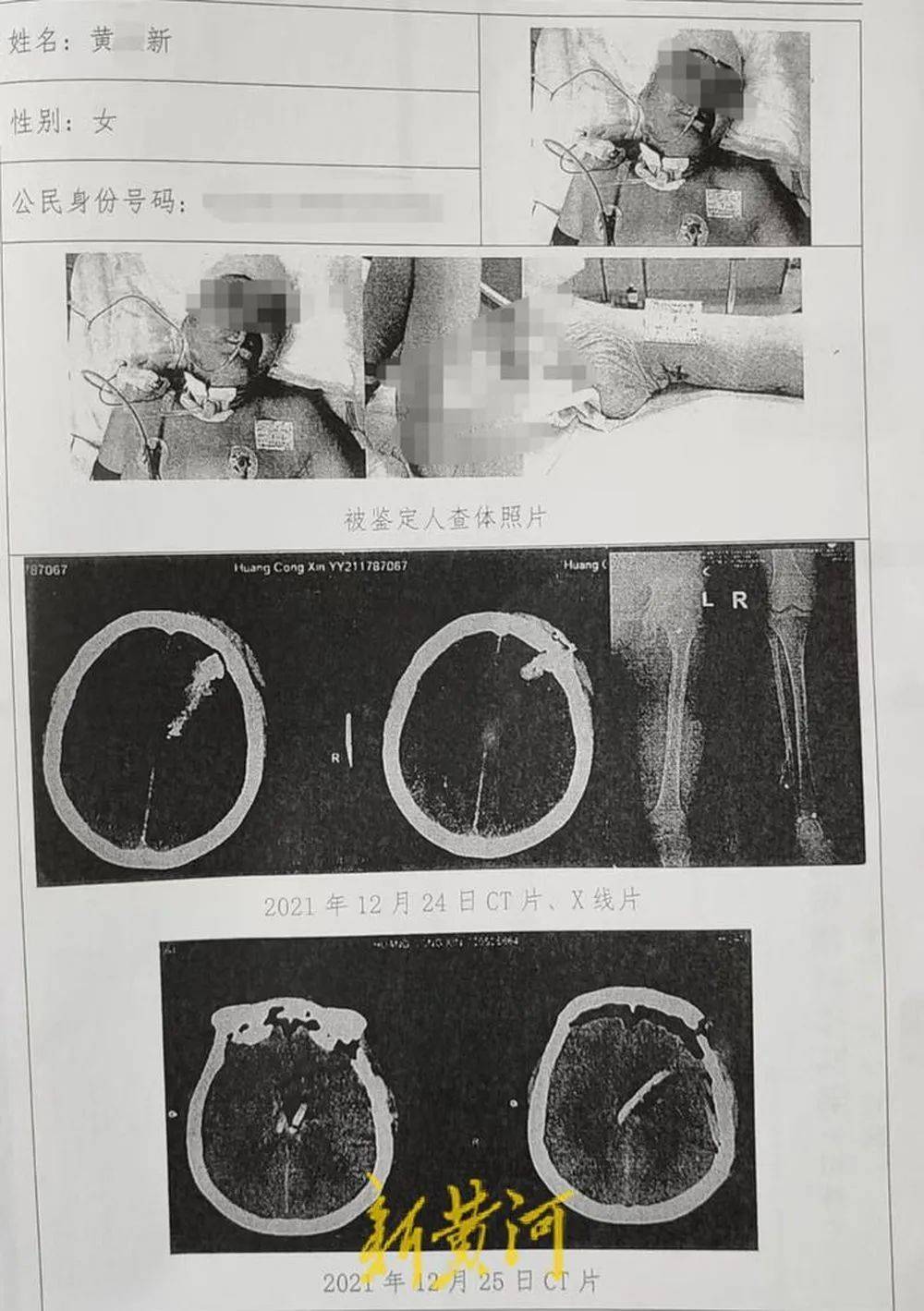 六旬老人遭狩猎者枪击致重伤<strong></p>
<p>抹茶交易所合约说明</strong>,开枪者两次逃离现场,事发4小时后冒充“好心人”施救,家属:耽误了最佳救治时间