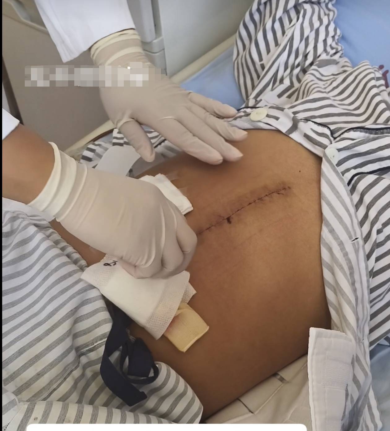 奶奶在哭<strong></p>
<p>抹茶交易所如何加杠杆</strong>,宝宝在笑!40天女婴重病,00后父亲割肝救女,术后这一幕让网友泪奔