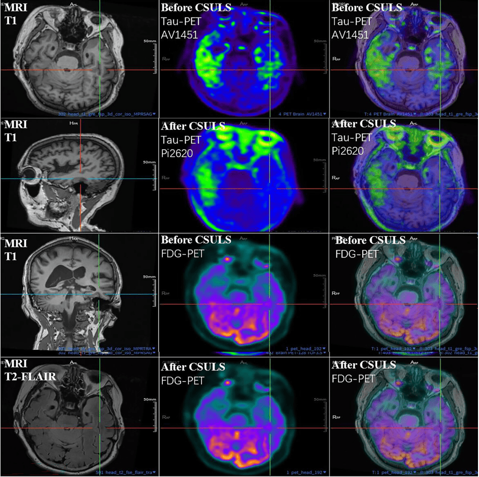 300多家医院抢着做的手术<strong></p>
<p>抹茶交易所ios版</strong>,为何突被禁?