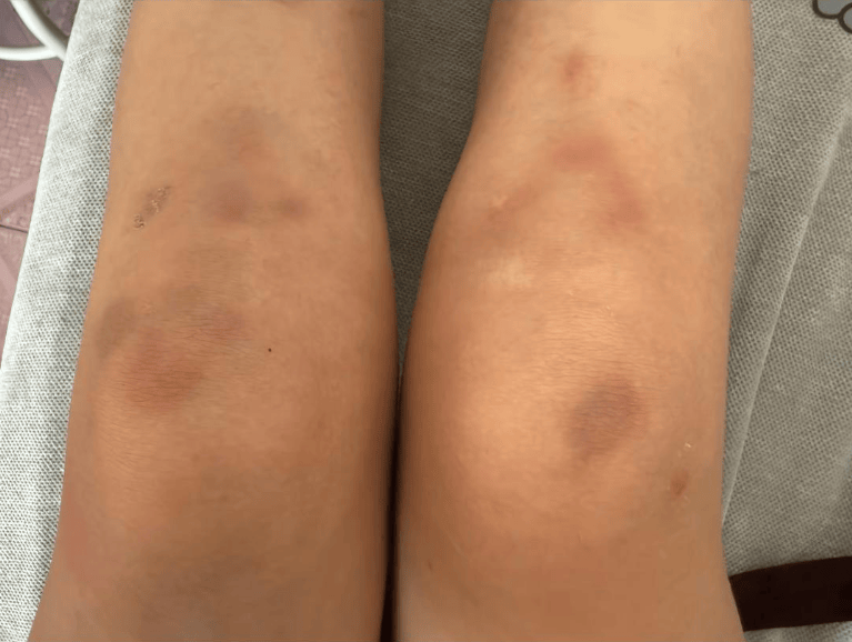 女子自称因工资问题被老板锁办公室里打 警方:双方已到派出所<strong></p>
<p>抹茶交易所</strong>,是否打人还在调查