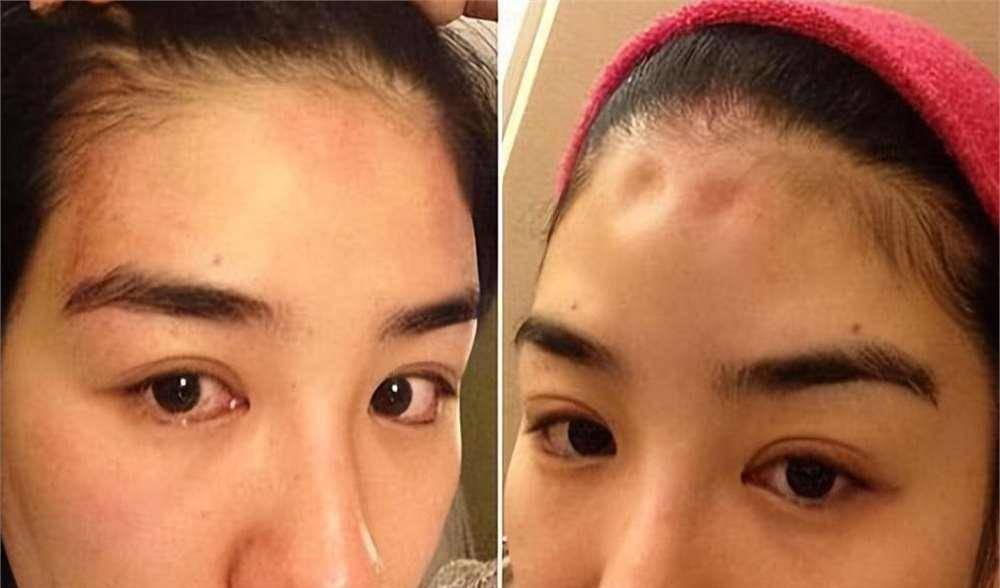 罗霖被家暴17年<strong></p>
<p>抹茶交易所</strong>，蓝洁瑛遭性侵暴力还被围观！女明星的暴力事件还有很多