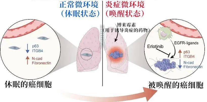 长期炎症会“唤醒”癌细胞<strong></p>
<p>越南抹茶交易所</strong>!这份抗炎指南每个人都该看看