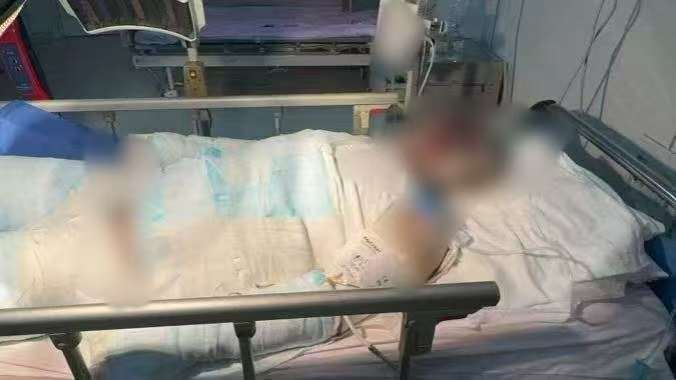 父子在哈尔滨一亲戚公司上班遇爆炸全身烧伤<strong></p>
<p>抹茶交易所杠杆代币</strong>，治疗花费近百万公司拒赔偿？亲戚回应