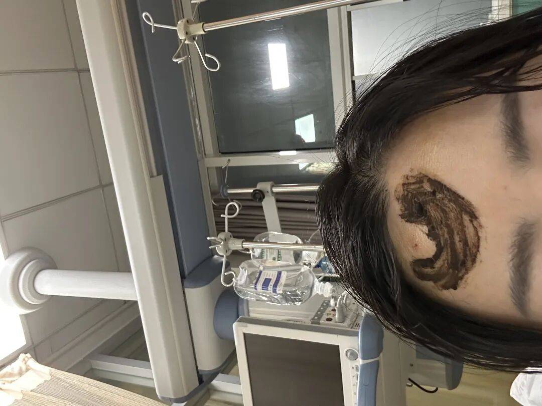 4名游客景区内遭马蜂袭击<strong></p>
<p>抹茶交易所杠杆代币</strong>,旅游度假区:是森林公园不卖门票,蜇伤先就医后提供证据投诉