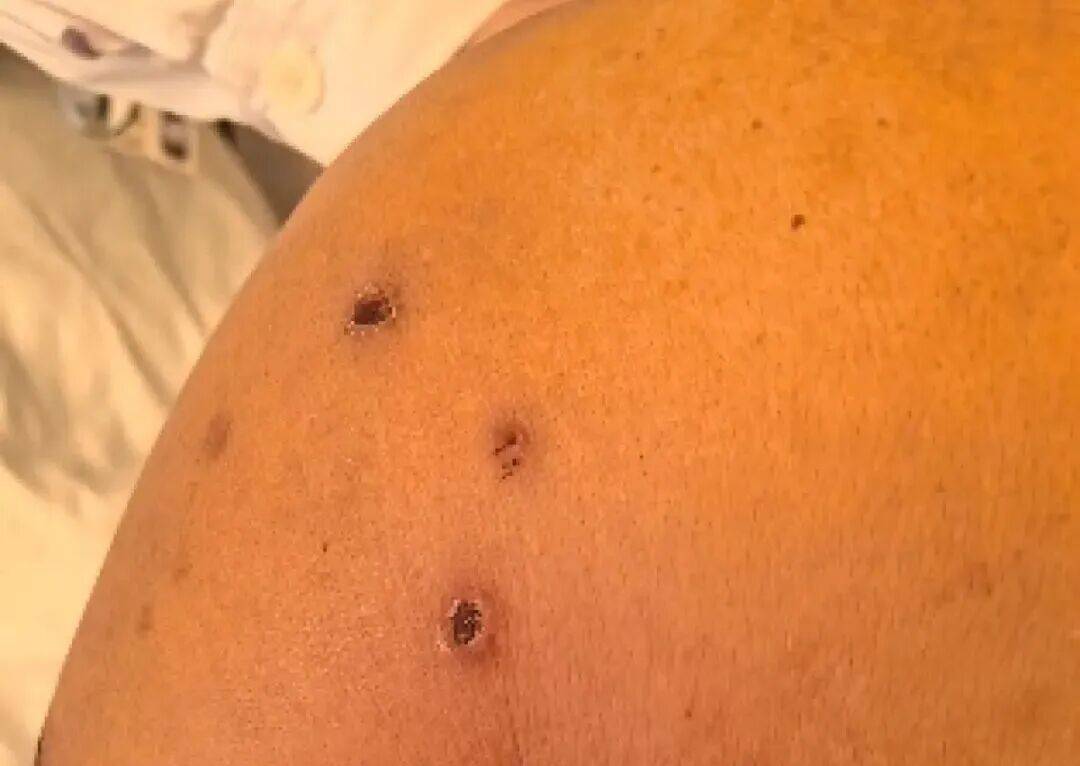 深圳一市民突遭马蜂围袭！已进入高发期<strong></p>
<p>抹茶交易所杠杆代币</strong>，千万别招惹！