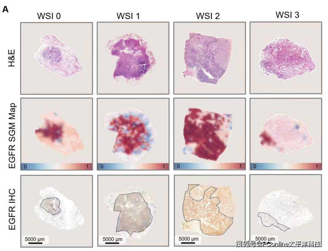 准确率高达 99%<strong></p>
<p>抹茶交易所哪个最好</strong>!腾讯 AI 可预测肺癌基因突变