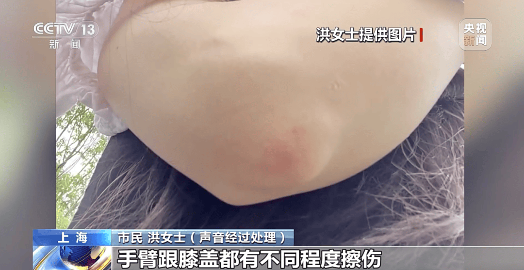 央视曝光：共享单车骑行中自动锁车<strong></p>
<p>海外版下载链接</strong>，致多人受伤！北京、广东等多地都发生类似情况，原因查明