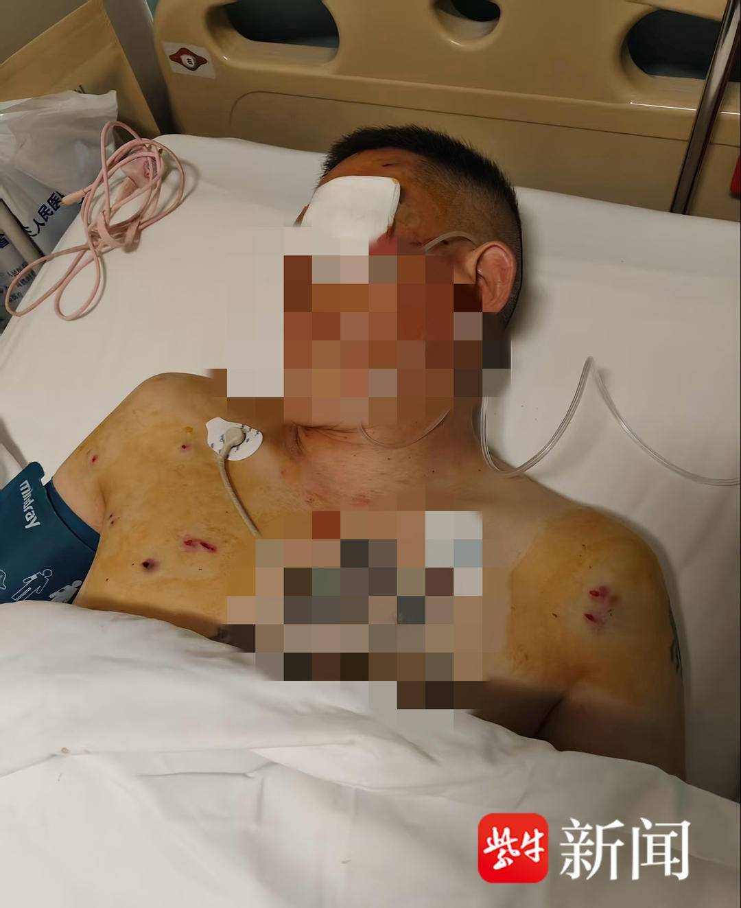 紫牛头条|男子取款170万在银行门口遭抢劫致重伤<strong></p>
<p>交通银行股票</strong>,当事人认为银行保安未帮忙应担责